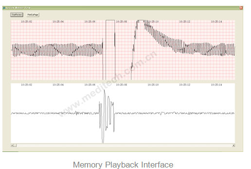 Memory Playback includes ECG, grid, speech waveform, corresponding time mark, Auto play button, and button for printing current page.