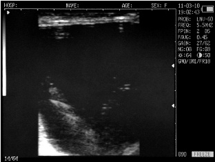Sonovet ultrasound Scanner Sonovet ultrasound Scanner