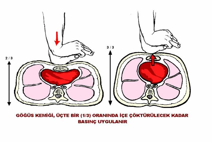 kalp masajı